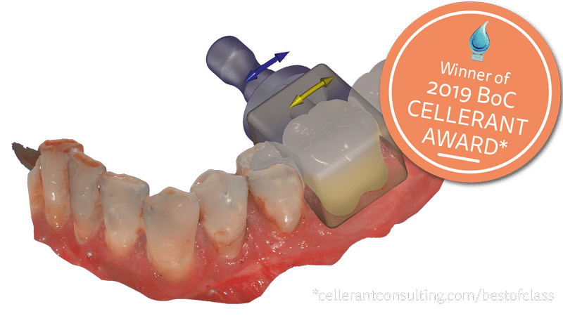 Exocad Chairside CAD - ISD-Digital